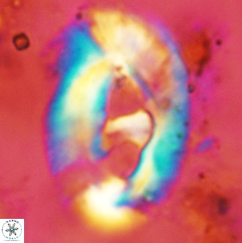 Helicosphaera truempyi 2446