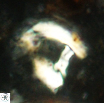 Helicosphaera truempyi 2332