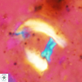 Helicosphaera truempyi 2333