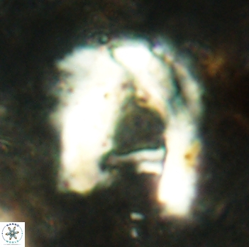 Helicosphaera truempyi 2335