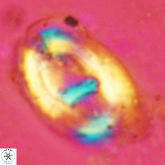 Helicosphaera truempyi 2364