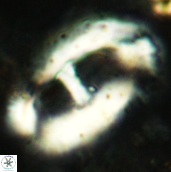 Helicosphaera truempyi 2378