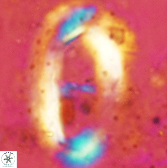 Helicosphaera truempyi 2380