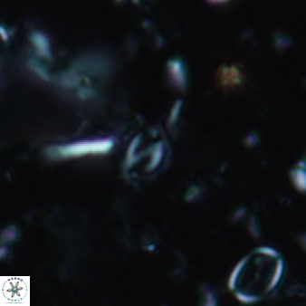 Helicosphaera walbersdorfensis 664