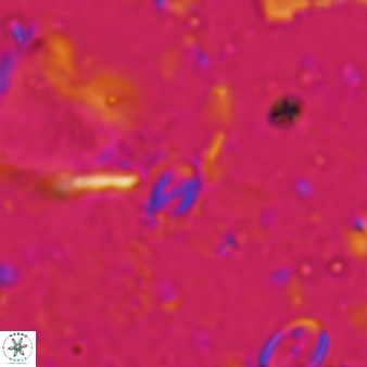 Helicosphaera walbersdorfensis 665