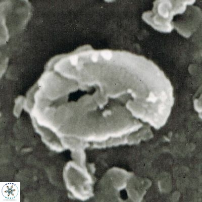Helicosphaera walbersdorfensis S0 3 1