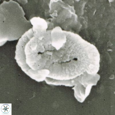 Helicosphaera walbersdorfensis S0 11 1