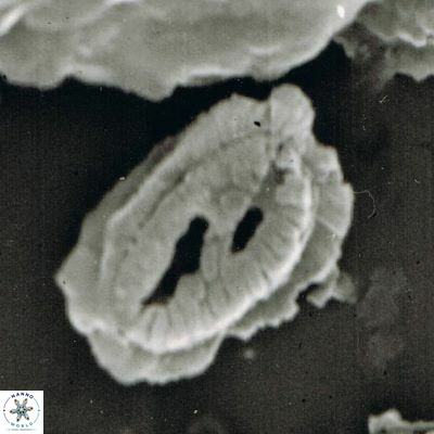 Helicosphaera walbersdorfensis S0 1 1