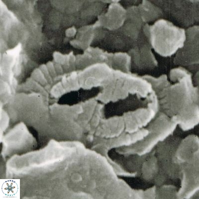 Helicosphaera walbersdorfensis S0 2 1