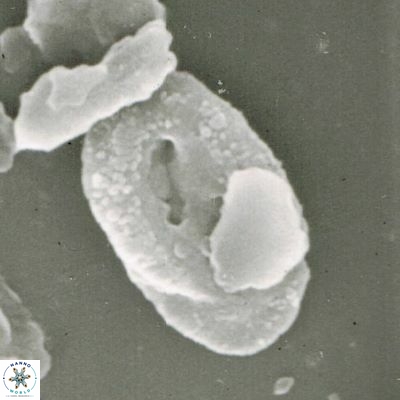 Helicosphaera walbersdorfensis S0 4 1