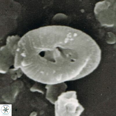 Helicosphaera walbersdorfensis S0 6 1
