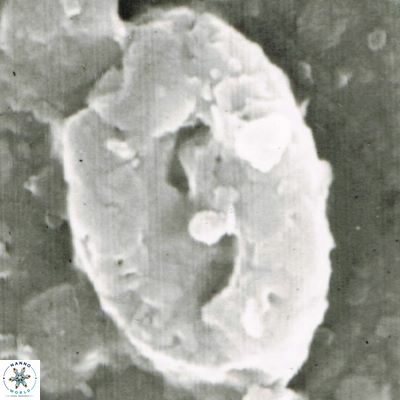 Helicosphaera walbersdorfensis S0 8 1