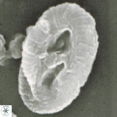Helicosphaera walbersdorfensis S0 9 1