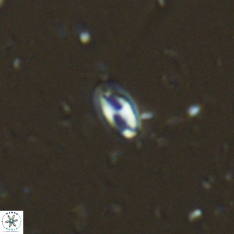 Helicosphaera walbersdorfensis VR 03185