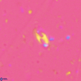 Helicosphaera walbersdorfensis VR 03186