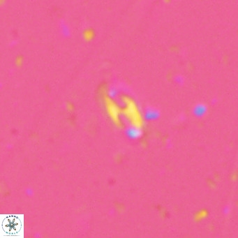 Helicosphaera walbersdorfensis VR 03186