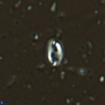 Helicosphaera walbersdorfensis VR 03187