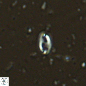 Helicosphaera walbersdorfensis VR 03187