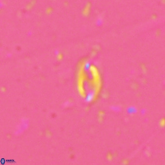 Helicosphaera walbersdorfensis VR 03188