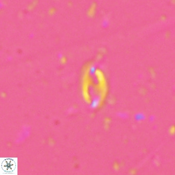 Helicosphaera walbersdorfensis VR 03188