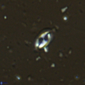 Helicosphaera walbersdorfensis VR 03189