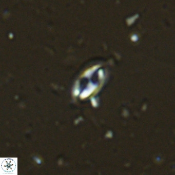 Helicosphaera walbersdorfensis VR 03189