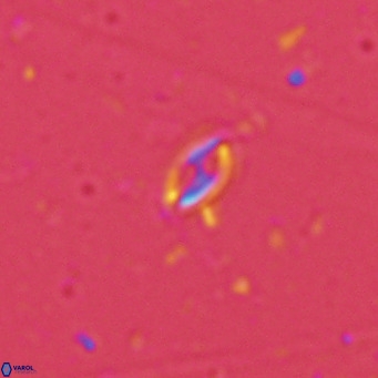 Helicosphaera walbersdorfensis VR 03190