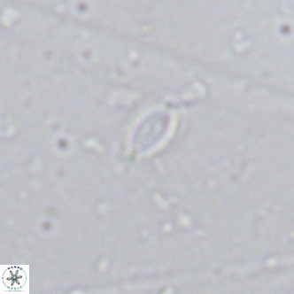Helicosphaera walbersdorfensis VR 03191