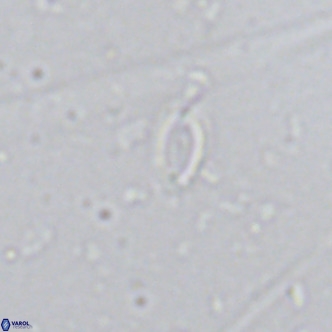 Helicosphaera walbersdorfensis VR 03192