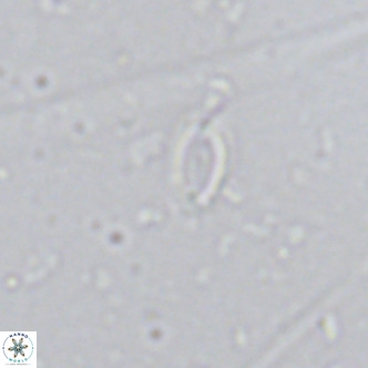 Helicosphaera walbersdorfensis VR 03192