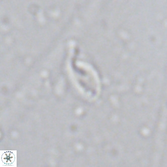 Helicosphaera walbersdorfensis VR 03193