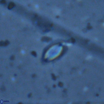 Helicosphaera walbersdorfensis VR 03194