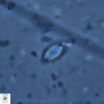 Helicosphaera walbersdorfensis VR 03194