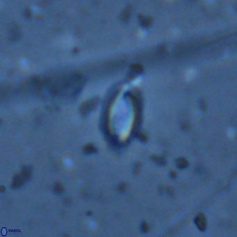 Helicosphaera walbersdorfensis VR 03195