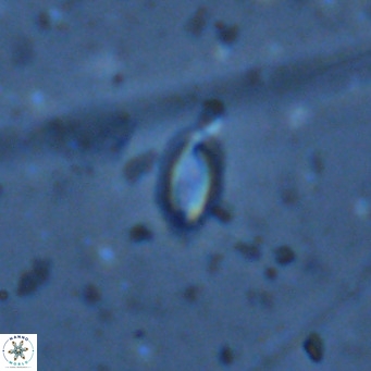 Helicosphaera walbersdorfensis VR 03195
