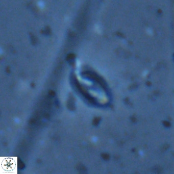 Helicosphaera walbersdorfensis VR 03196