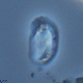 Helicosphaera wallichii VR 04840