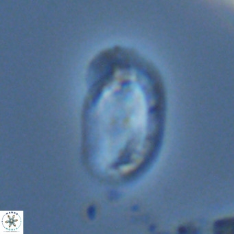 Helicosphaera wallichii VR 04840