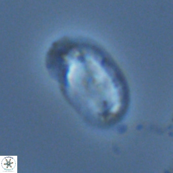 Helicosphaera wallichii VR 04841