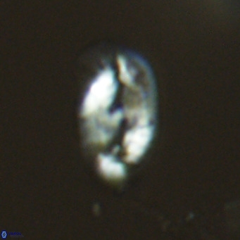 Helicosphaera wallichii VR 04831