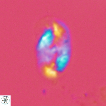Helicosphaera wallichii VR 04832