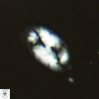 Helicosphaera wallichii VR 04834