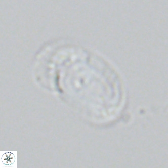 Helicosphaera wallichii VR 04835