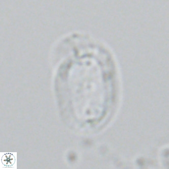 Helicosphaera wallichii VR 04836