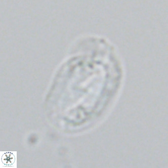 Helicosphaera wallichii VR 04837