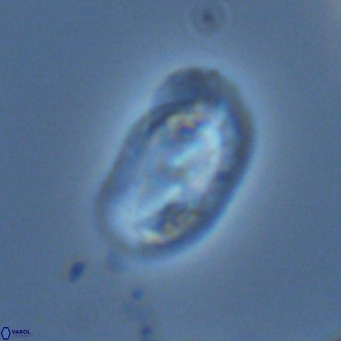 Helicosphaera wallichii VR 04839