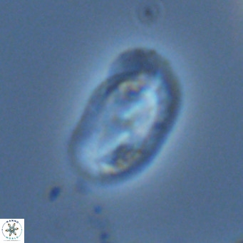 Helicosphaera wallichii VR 04839