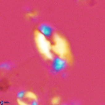 Helicosphaera wallichii VR 05168