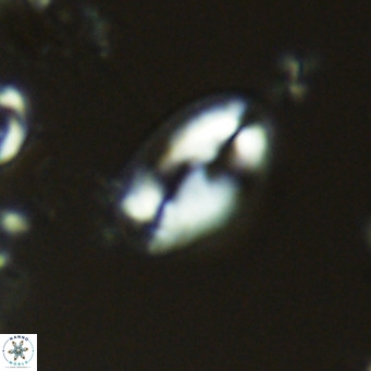 Helicosphaera wallichii VR 05170