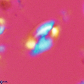 Helicosphaera wallichii VR 05172